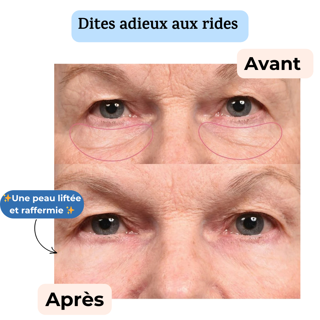 Secrets de Jeunesse : Patchs Anti-Âge Réutilisables (Visage, Cou et Décolleté)