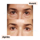 Secrets de Jeunesse : Patchs Anti-Âge Réutilisables (Visage, Cou et Décolleté)